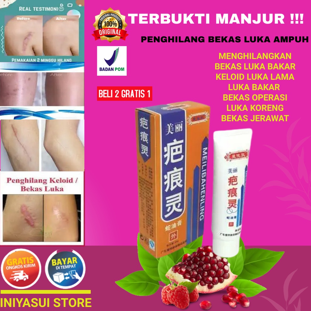 Obat penghilang bekas luka