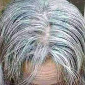 ASLI PENGHILANG UBAN/PENGHITAM RAMBUT AMPUH HALAL *NO CAT RAMBUT* (COD)