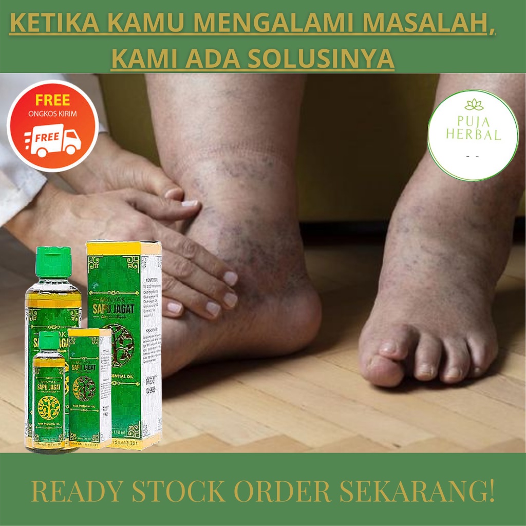 Obat Kaki Bengkak, Obat Oles Kaki Bengkak, Kaki Terkilir, Keseleo - Minyak Sapu Jagat
