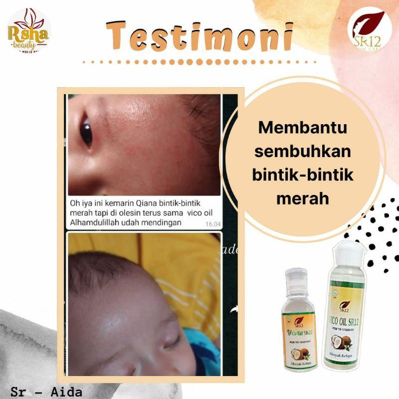 VCO Bayi - Obat Gatal Gatal - Biang Keringat - Ruam Popok Bayi - Obat Ruam Merah - VICO SR12 Minyak Kelapa 100% Herbal Aman BPOM