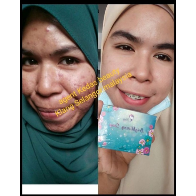 sabun kedas beauty, Pemutih Wajah, Badan ,Flek ,Ketiak ,Pria, Original-6