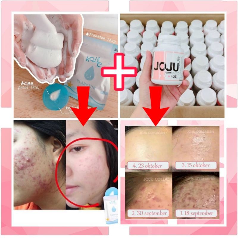 JOJU COLAGEN DAN PLANKTON SOAP PAKET PEMUTIH TERAMPUH ORIGINAL
