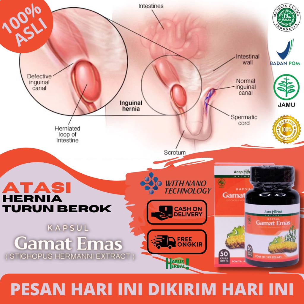 Obat Turun Berok Alami, Obat Hernia, Obat Hidrokel Dan Varikokel, Obat Buah Zakar Bengkak, Testis Be