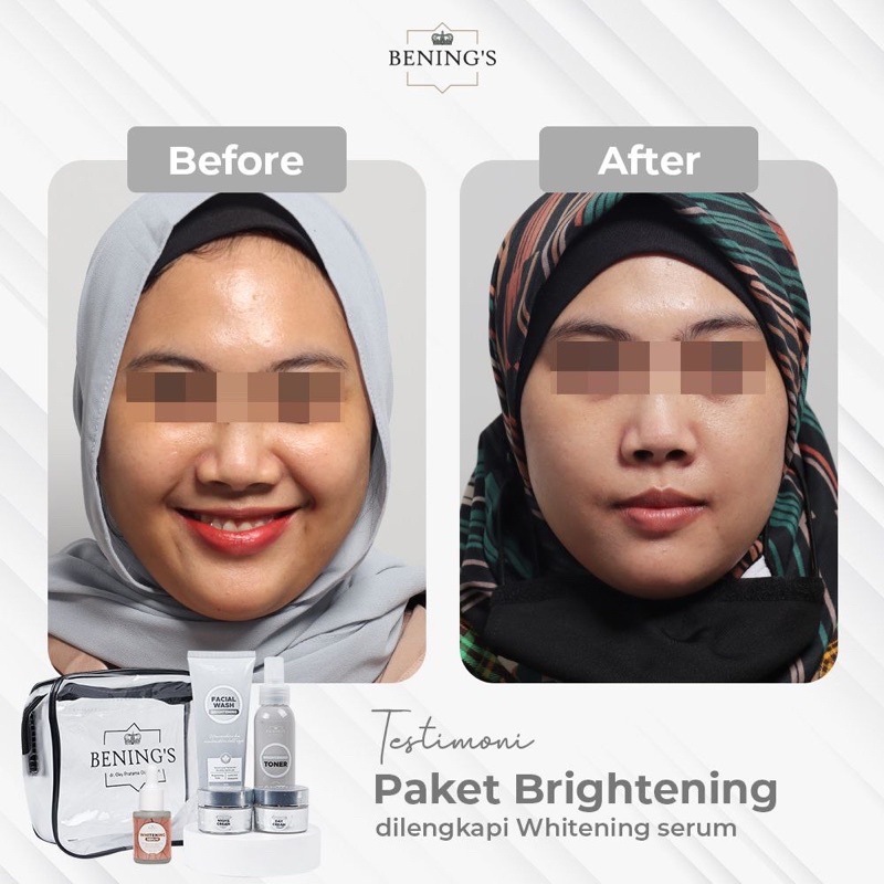 BENINGS SKINCARE DR OKY PRATAMA PAKET BRIGHTENING UNTUK MENCEGAH DAN MENGATASI KULIT KUSAM AGAR GLOWING ( BENINGS INDONESIA )-5