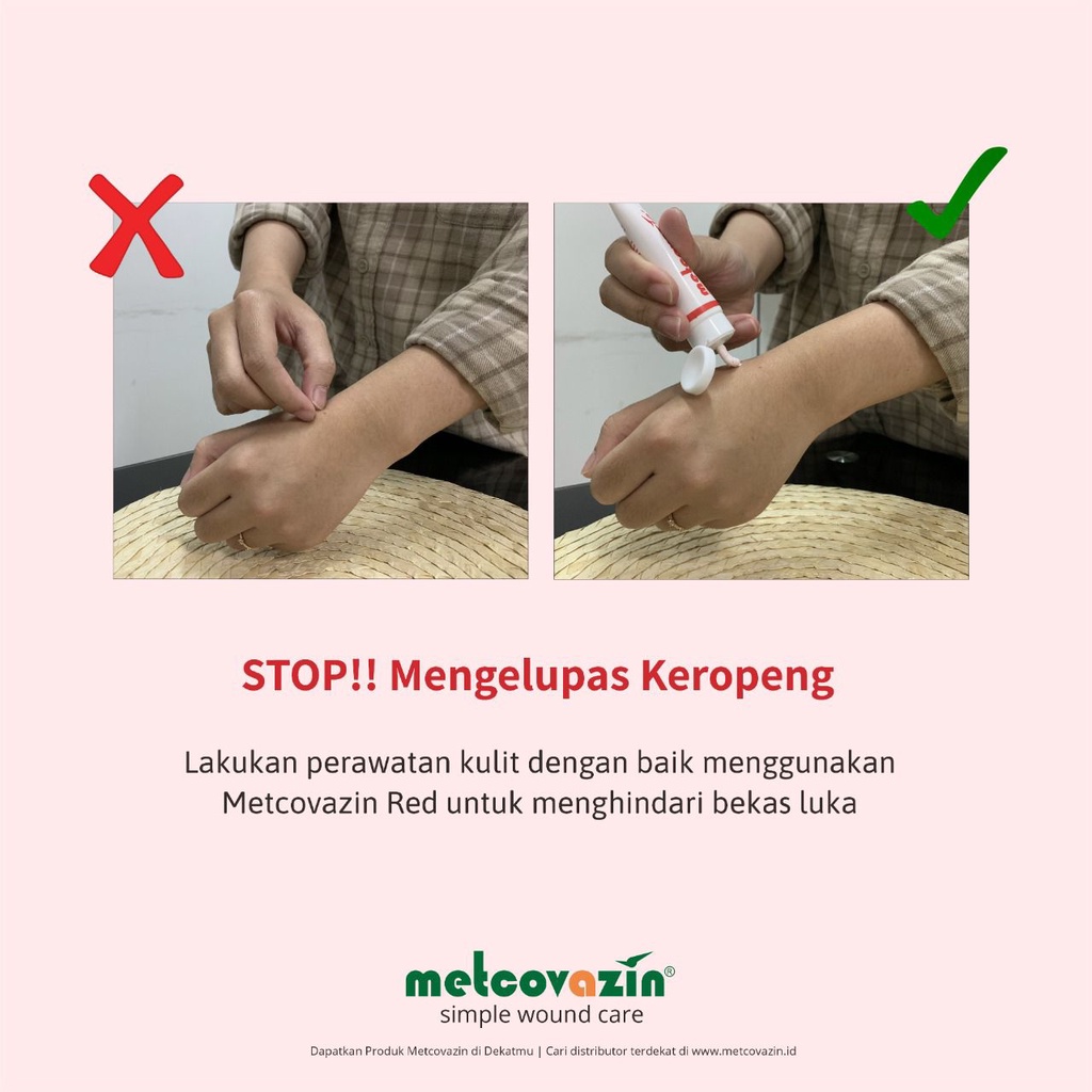 (Bisa COD) TERMURAH Metcovazin Red 25gr | Salep Segala Jenis Luka