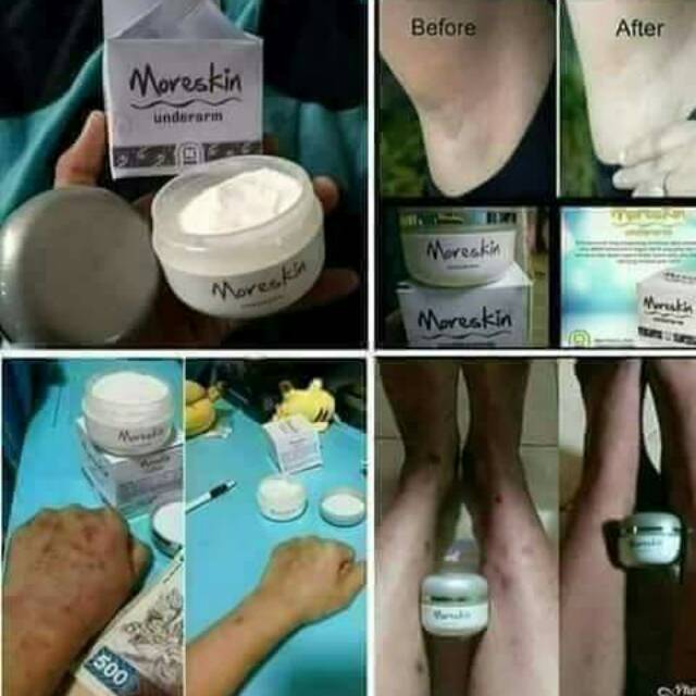 Moreskin underarm