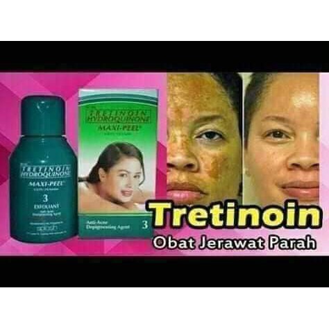 Maxipeel hijau Tretinoin Hydroquinone Original
