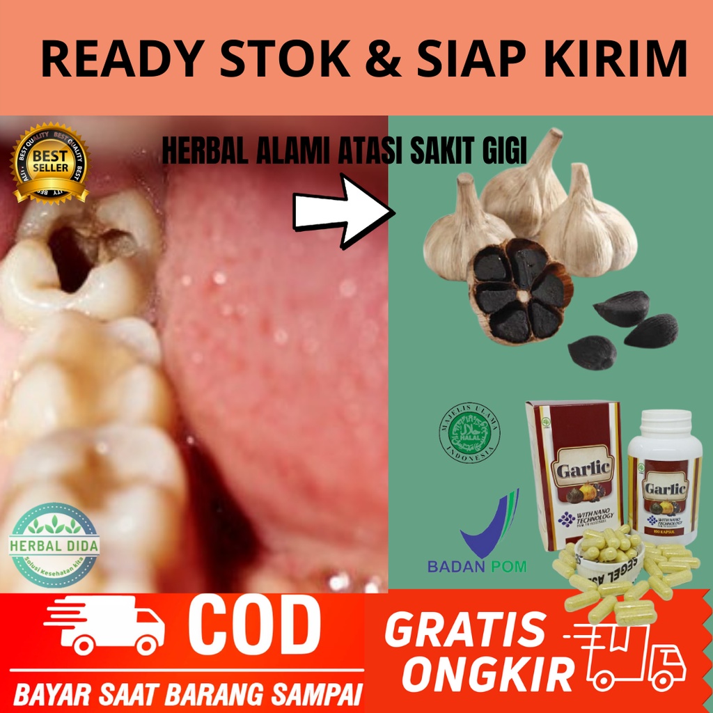 Obat Sakit Gigi, Obat Sakit Gigi Berlubang, Obat sakit gusi bengkak / sakit gigi goyang, Obat herbal
