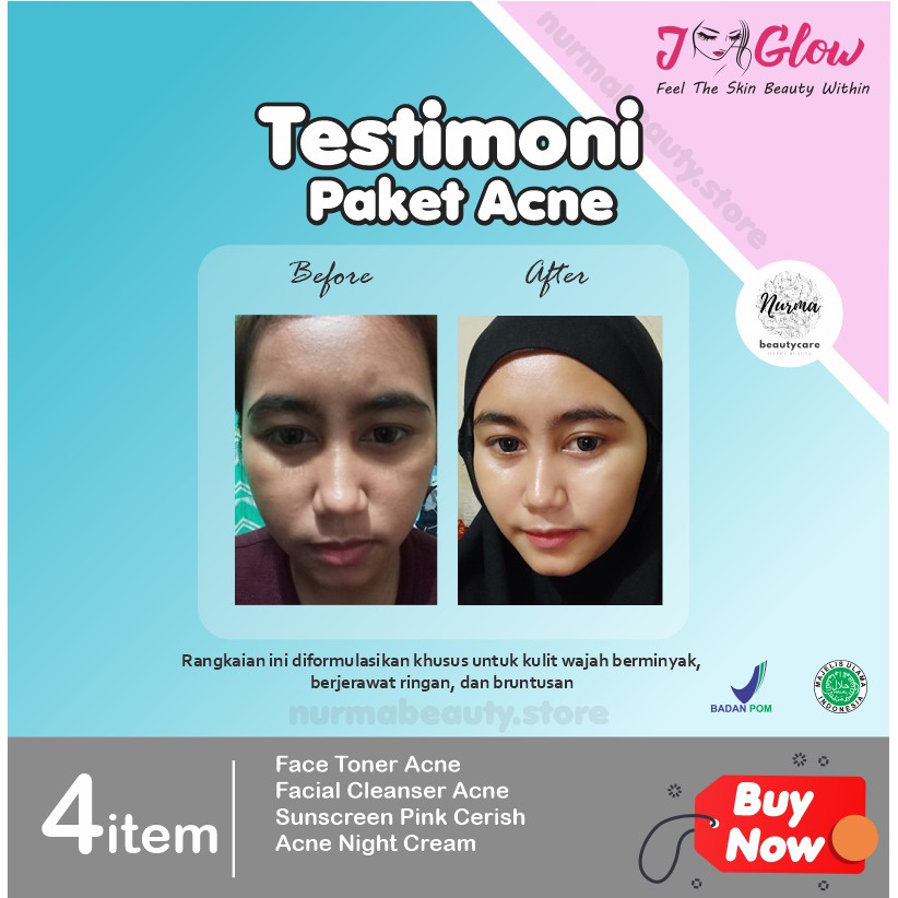 Jglow J glow Skincare Acne Krim Jerawat Perawatan Kecantikan Pemutih Wajah Glow Glowing BPOM Aman-7