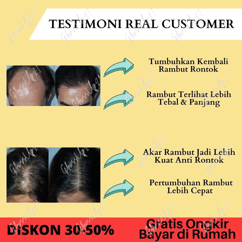 PENUMBUH RAMBUT KEBOTAKAN - SHAMPO PENUMBUH RAMBUT - BIO HERBAL GINSENG PAKET SHAMPO &amp; HAIR TONIC ORIGINAL