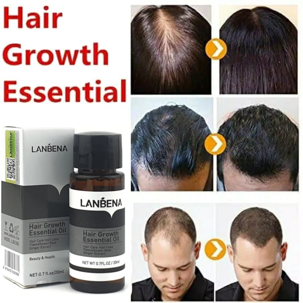 LANBENA Hair Growth Essential Oil Serum Penumbuh Rambut Anti Botak ORI