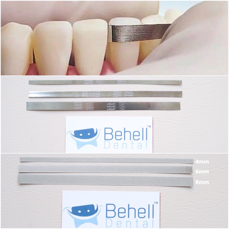 Kikir Gigi Dental Abrasive Strip Steelcarbo strip Horico . Polishing Finishing penghilang lem behel . Slicing Ortho