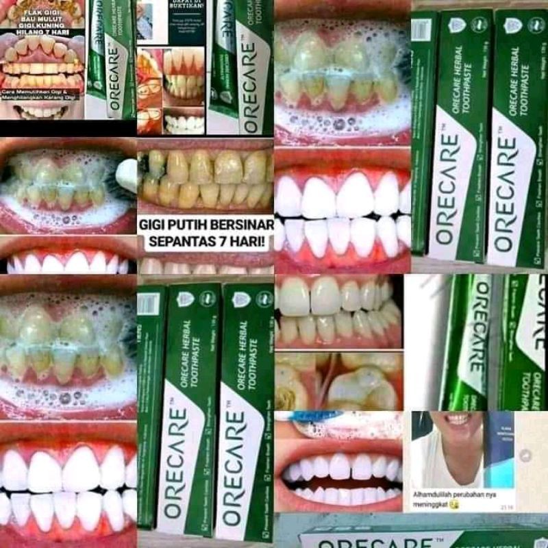 pasta gigi Orecare