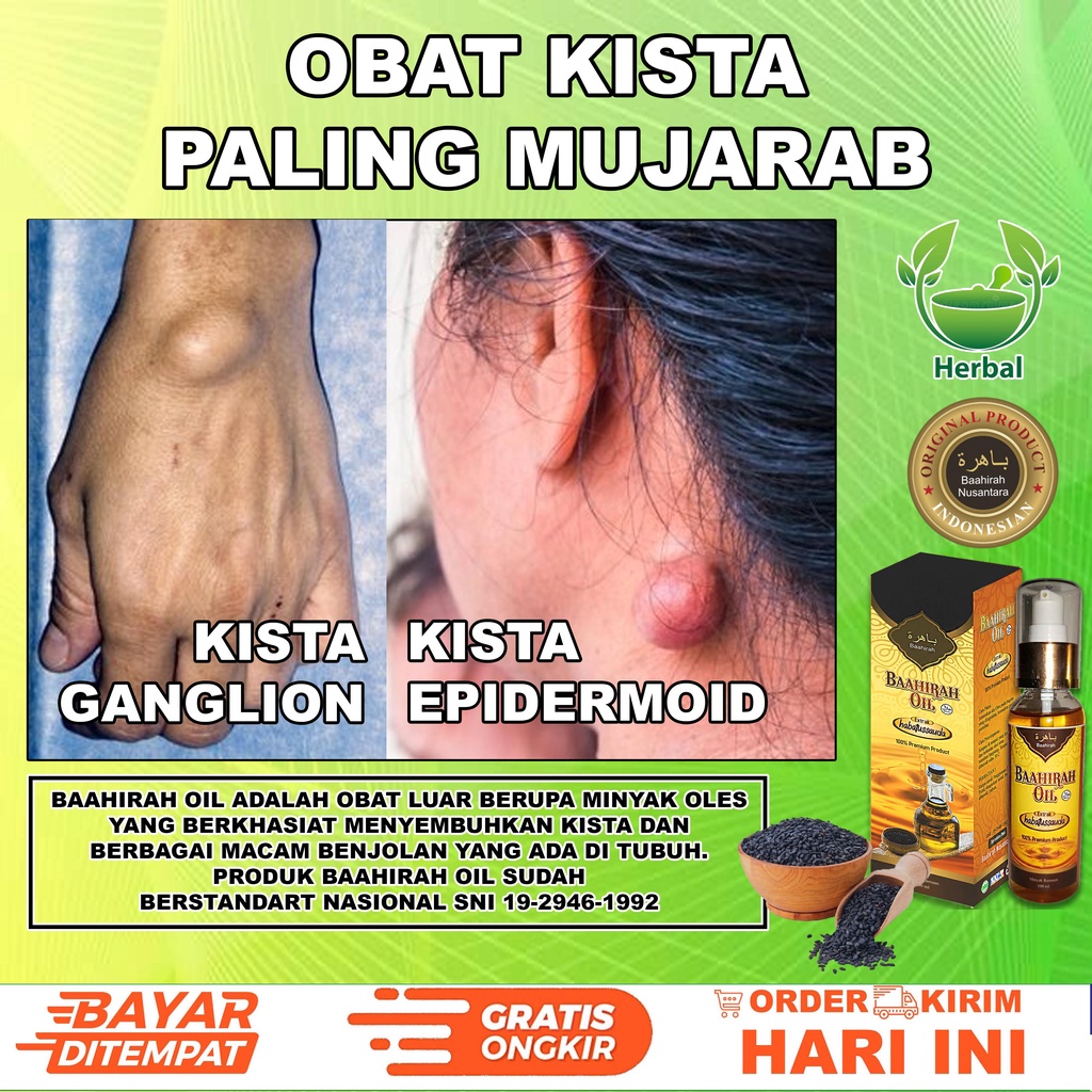 Baahirah Oil (TERLARIS) Obat segala benjolan tubuh