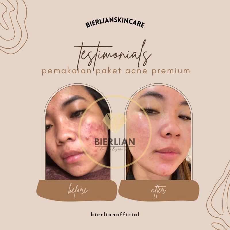 BIERLIAN SKINCARE CREAM WAJAH WHITE GLOW/SUPER WHITE/ACNE/FLEK [Free Pouch+Gift]-2