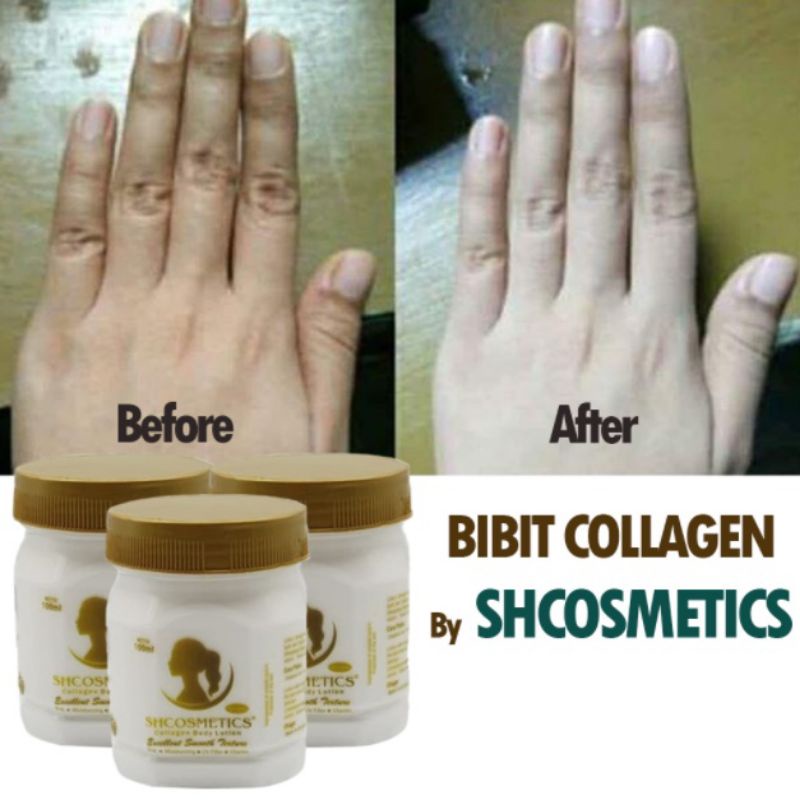 Lotion Pemutih Kulit Pria &amp; Wanita 10X Lebih Cepat Pemutih Badan Permanen / Bibit Pemutih Collagen SHCOMETICS ORIGINAL BPOM - Lotion Pemutih Badan Original