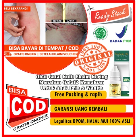 Obat selangkangan perih, Peradangan kulit atau dermatitis, Infeksi jamur. Infeksi parasit, obat gata