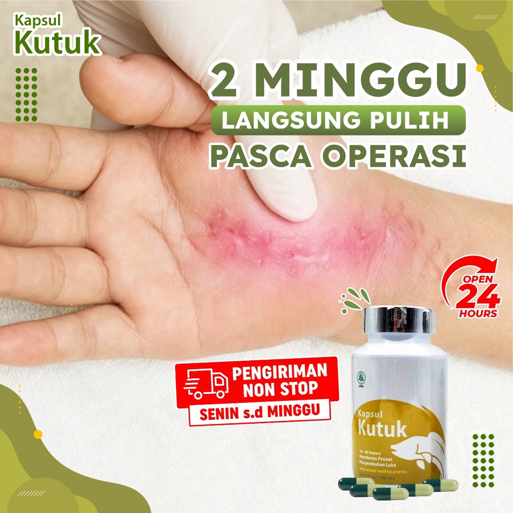 Kapsul Kutuk - Kapsul Pasca Operasi ASLI 100% - Ekstrak Albumin Albusmin Sari Kutuk Ikan Gabus Luka 5x Lebih Cepat Kering Asi Booster Cegah Keloid