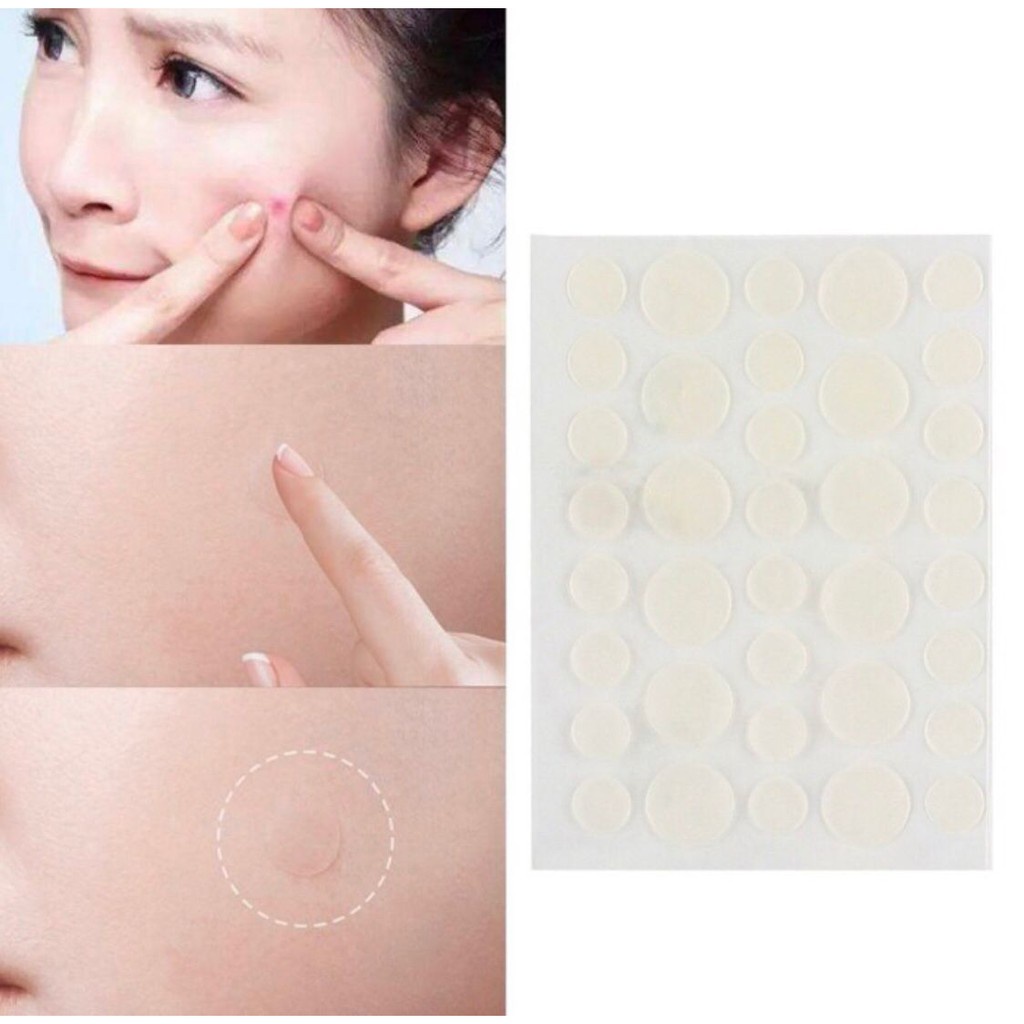 Acne Patch Pimple Blemish Removal Stickers Breathable Pimple Blemish Removal Sticker Facial Care 36 patches Acne Pimple