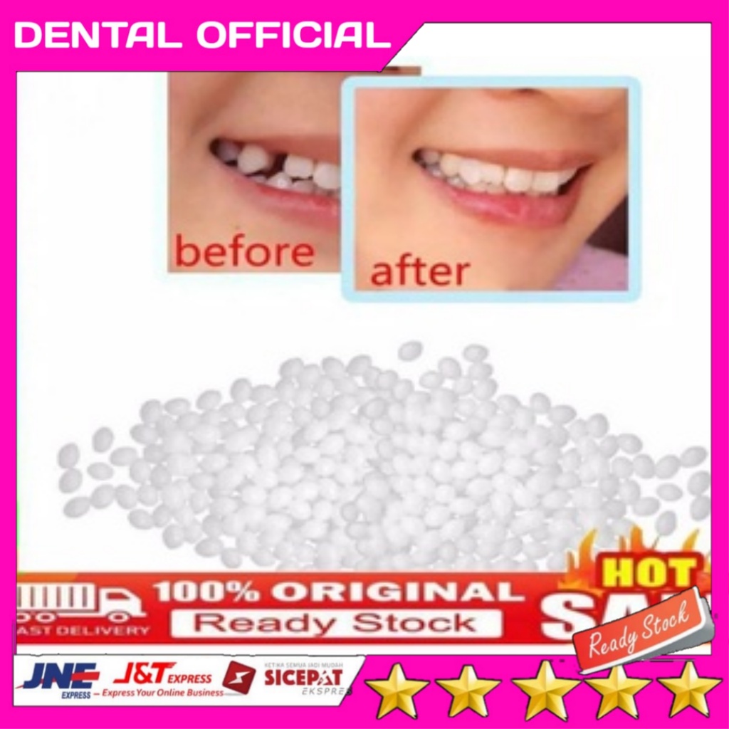 Temptooth Mulut 800 Butir Gigi Temporary / Penambal Gigi Berlubang / Gigi Palsu / Lem Gigi Padat / L