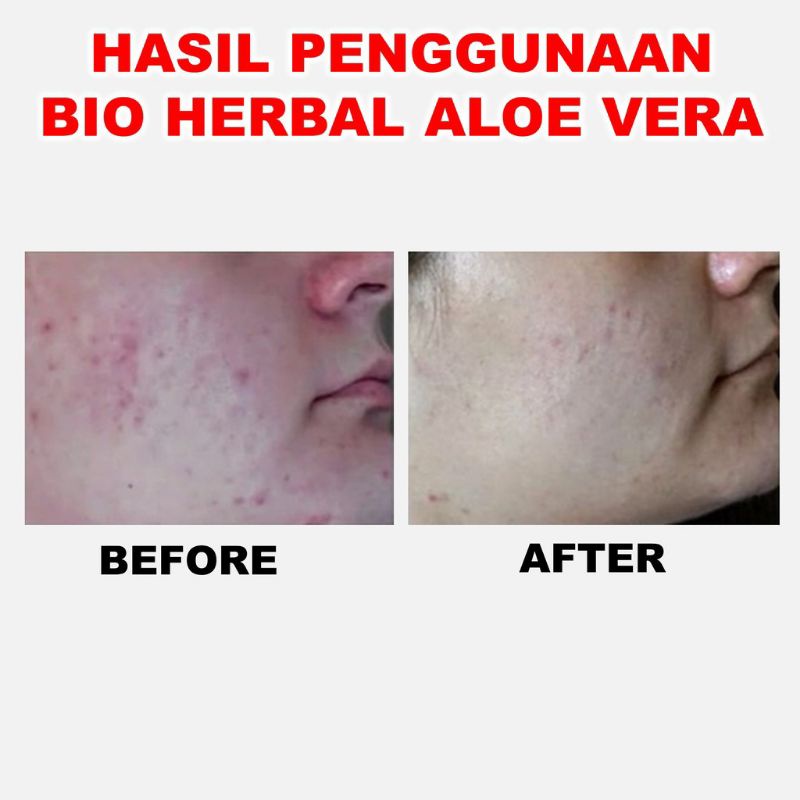 ORIGINAL ALOE VERA SOOTHING GEL | EKSTRAK LIDAH BUAYA MELEMBABKAN KULIT | Ada Stiker Kode Track Asli