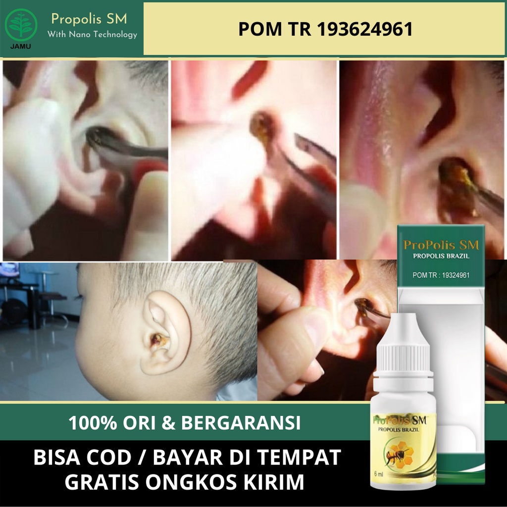 Jual Obat Telinga Tersumbat Obat Tetes Kotoran Telinga Obat