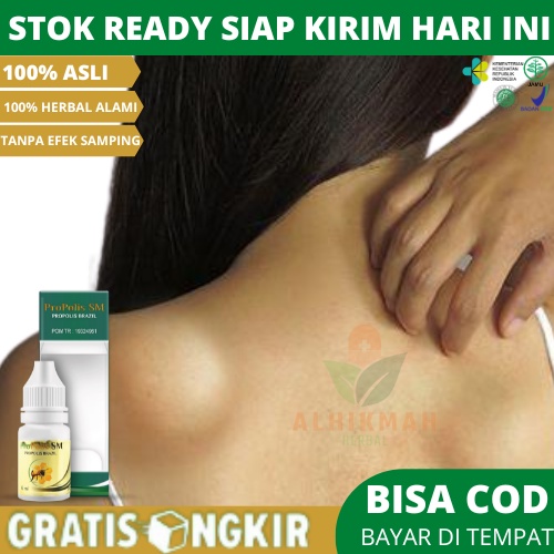 Obat Penghancur Benjolan di Punggung, Obat Benjolan di Punggung, Dermatofibroma, Obat Penghilang Ben