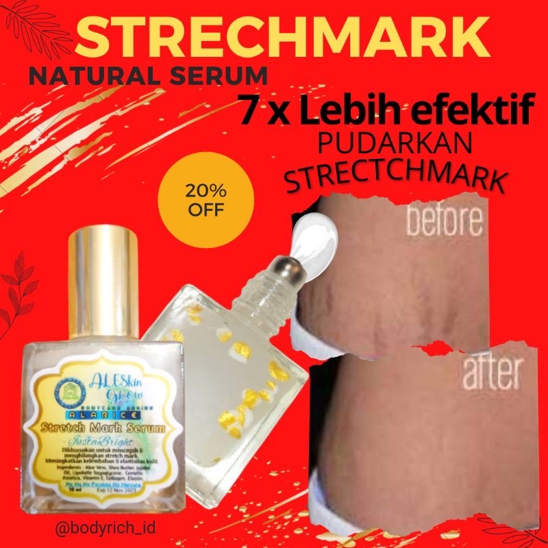 ALARICE STRECHMARK CREAM PENGHILANG STRETCH MARK PALING AMPUH PERMANEN UNTUK IBU HAMIL 1