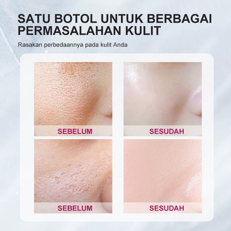 [BPOM]RtopR  Glycyrrhiza  Serum Perbaikan Pori Wajah  Kolagen  Anti-kerut  Minyak Krim Pemutih  Kontrol Menghidrasi Efektif Mengecilkan Pori-pori 20ml