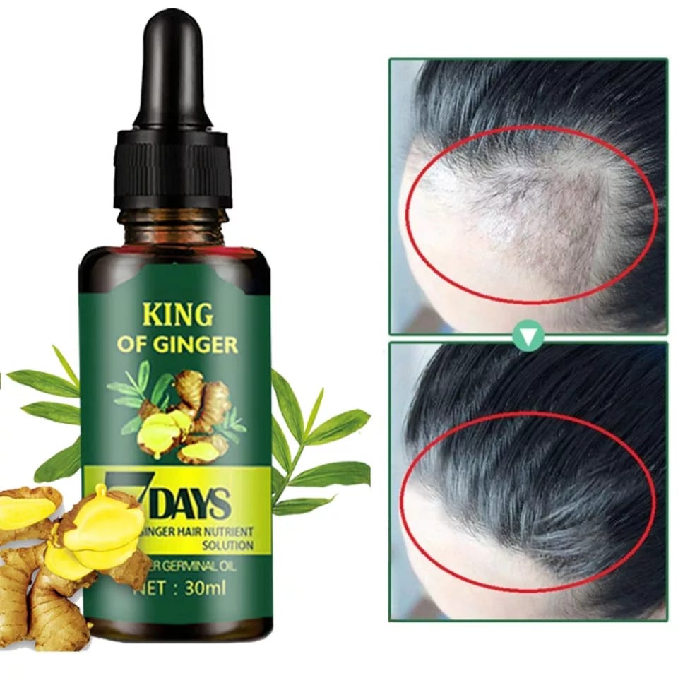 Obat Penumbuh Rambut / Anti Rontok Botak Ginger Germinal Oil 7 Days Aman-3