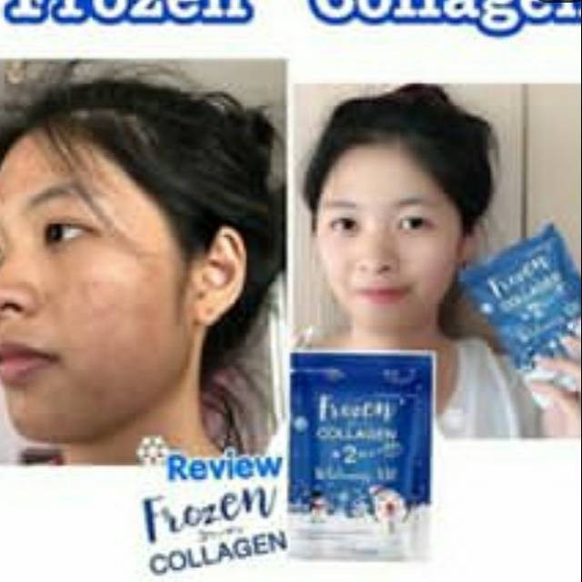 Frozen Collagen Original Shopee Indonesia