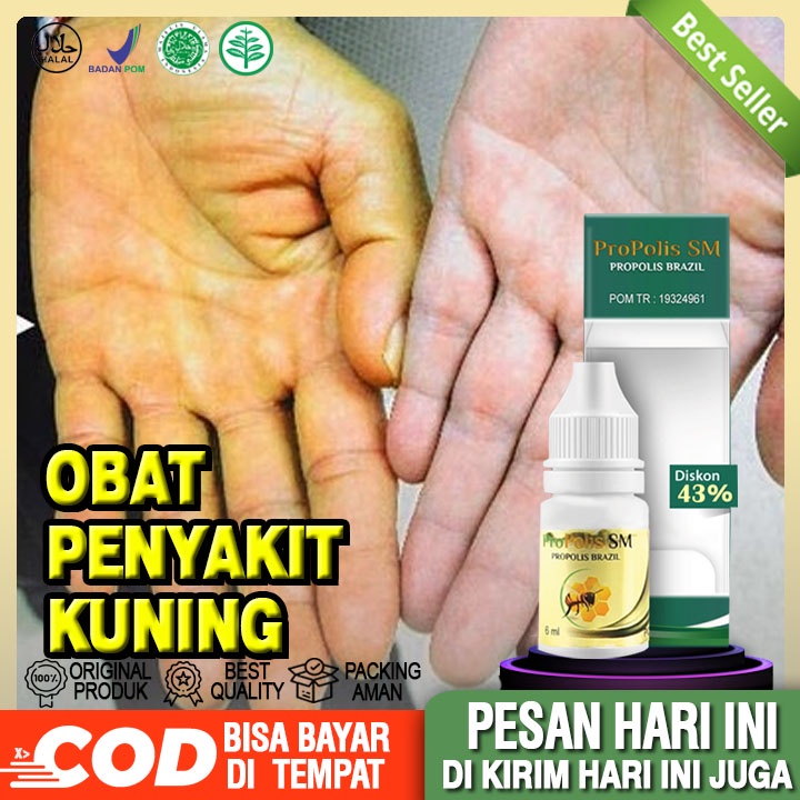 Obat Penyakit Kuning, Infeksi, Liver Hepatitis A,B,C Hati |Propolis Sm