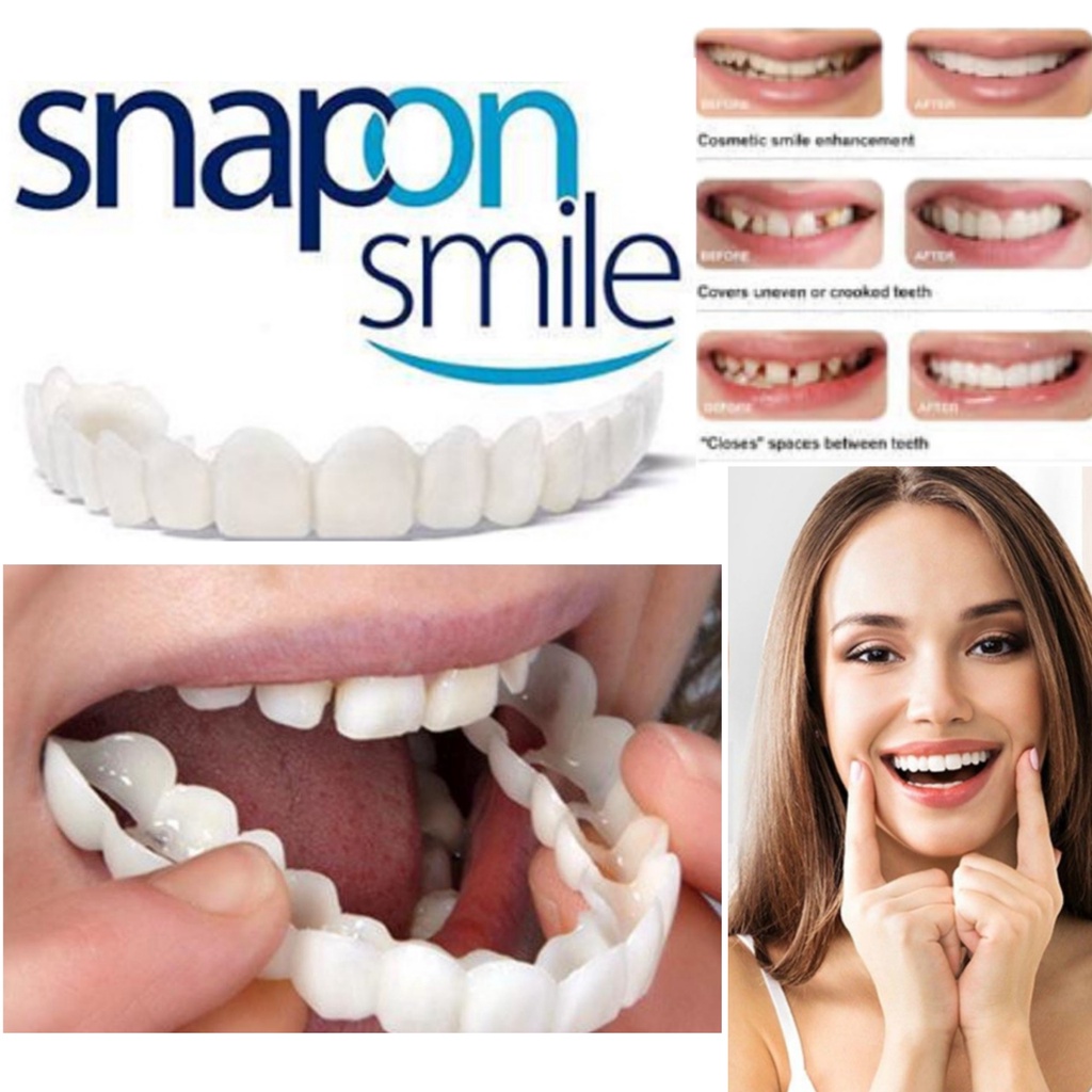 Snap On Smile Veneer Gigi Palsu Atas Bawah Instant Gigi Palsu Vener Silikon Alami Authentic Gigi Instan