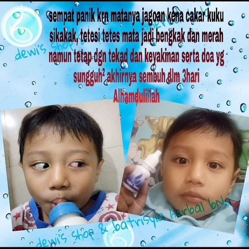 (BISA COD/ BAYAR DI TEMPAT) Obat tetes mata anak / obat tetes mata bayi/tetes mata anak bengkak merah berdarah bintitan belekan aman untuk bayi/ tetes mata iritasi anak