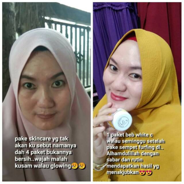 testimoni bebwhite c skincare