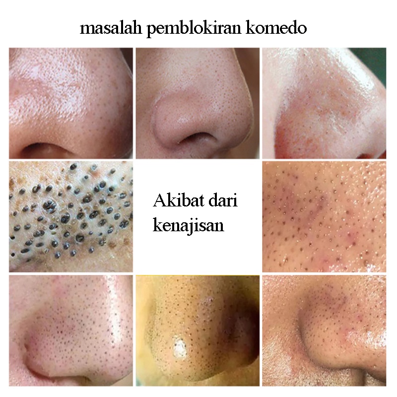 masker komedo 80g penghilang komed pencabut komedo  Pembersihan Wajah / Penghapusan Komedo / Penghapusan Jerawat / Pengecilan Pori-pori pembersih komedo