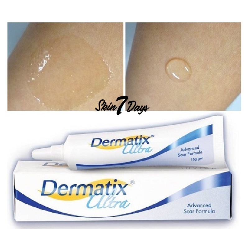 [ Dermatix Ultra ] Cream Penghilang Bekas Luka Operasi Iris Tergores Digigit Serangga Nyamuk / Luka Lama / Bakar / Gatal Hitam Koreng Di Kaki Oprasi Ampuh Advanced Scar Formula Gel Krim Wajah Keloid Stretchmark stretch mark Dermatik Dermatic Usa Original