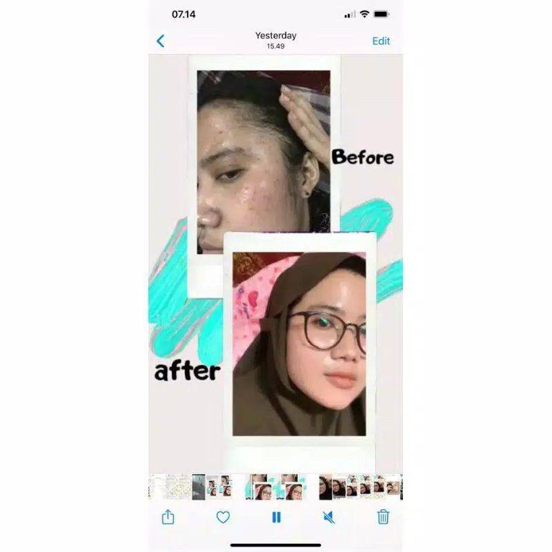 VAVL BEAUTY WATER / VIGHTNE BLEMISH SERUM /FACIAL CLEANSER / SUNSCREEN / BODY SERUM / PEELING SPARY