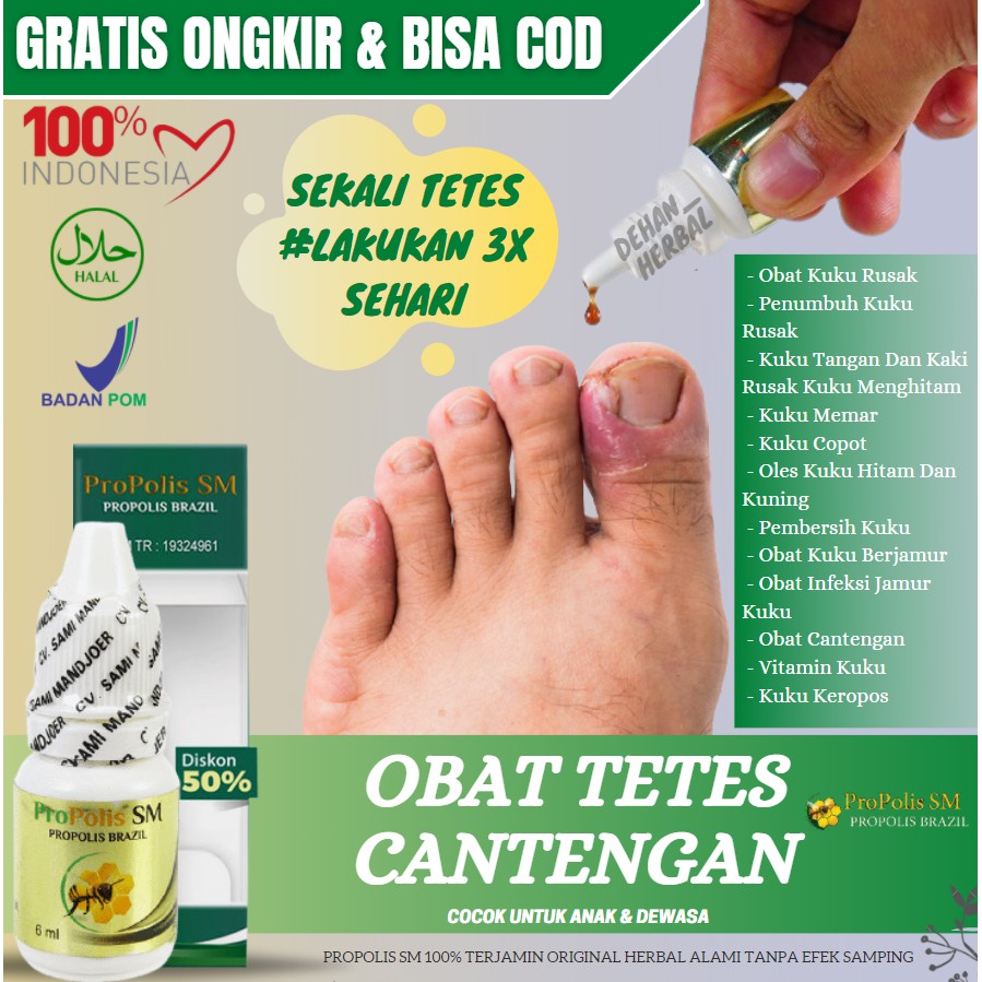 Obat Salep Cantengan Salep Penghilang Pengempes Daging Menonjol Di Kuku Kaki Jempol Propolis Sm Shopee Indonesia