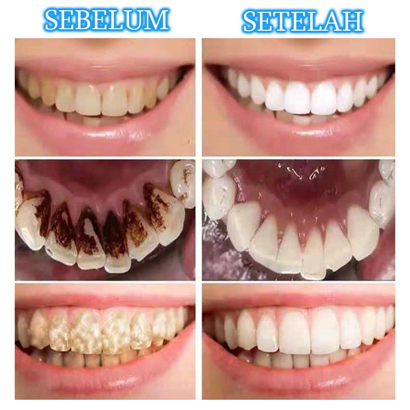 Teeth whitening Pasta gigi pemutih anak Toothpaste Memutihkan gigi 100G Menghilangkan noda teh Gigi kuning Plak Napas jernih melindungi gusi Jaga kebersihan mulut