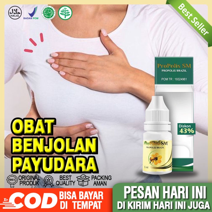 Obat Benjolan Payudara, Obat Herbal Untuk Benjolan Payudara, Obat Kanker Payudara