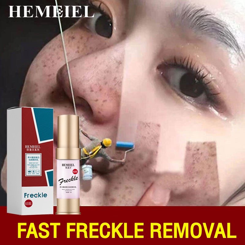 【BPOM】HEMEIEL Whitening Freckle Cream /Pemutih Wajah /Melasma Cream /Freckle Serum