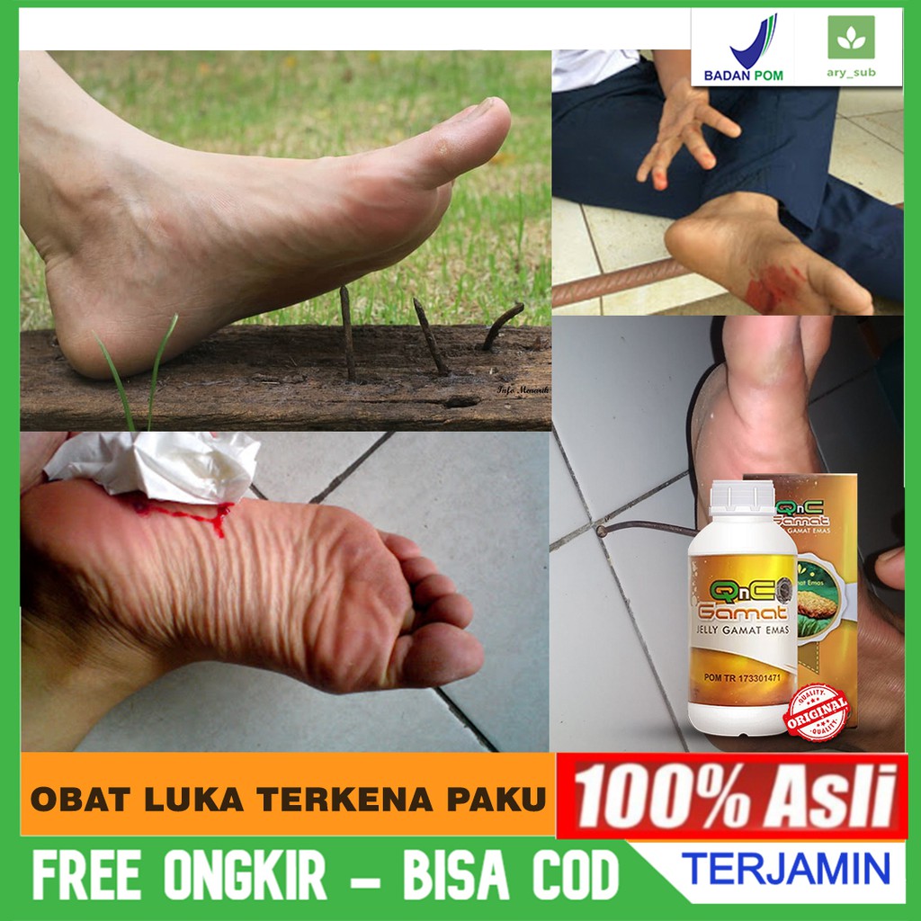 Obat Infeksi Luka Terkena Paku - Tetanus - Tertusuk Paku Berkarat Herbal Laris QnC Jelly Gamat Asli