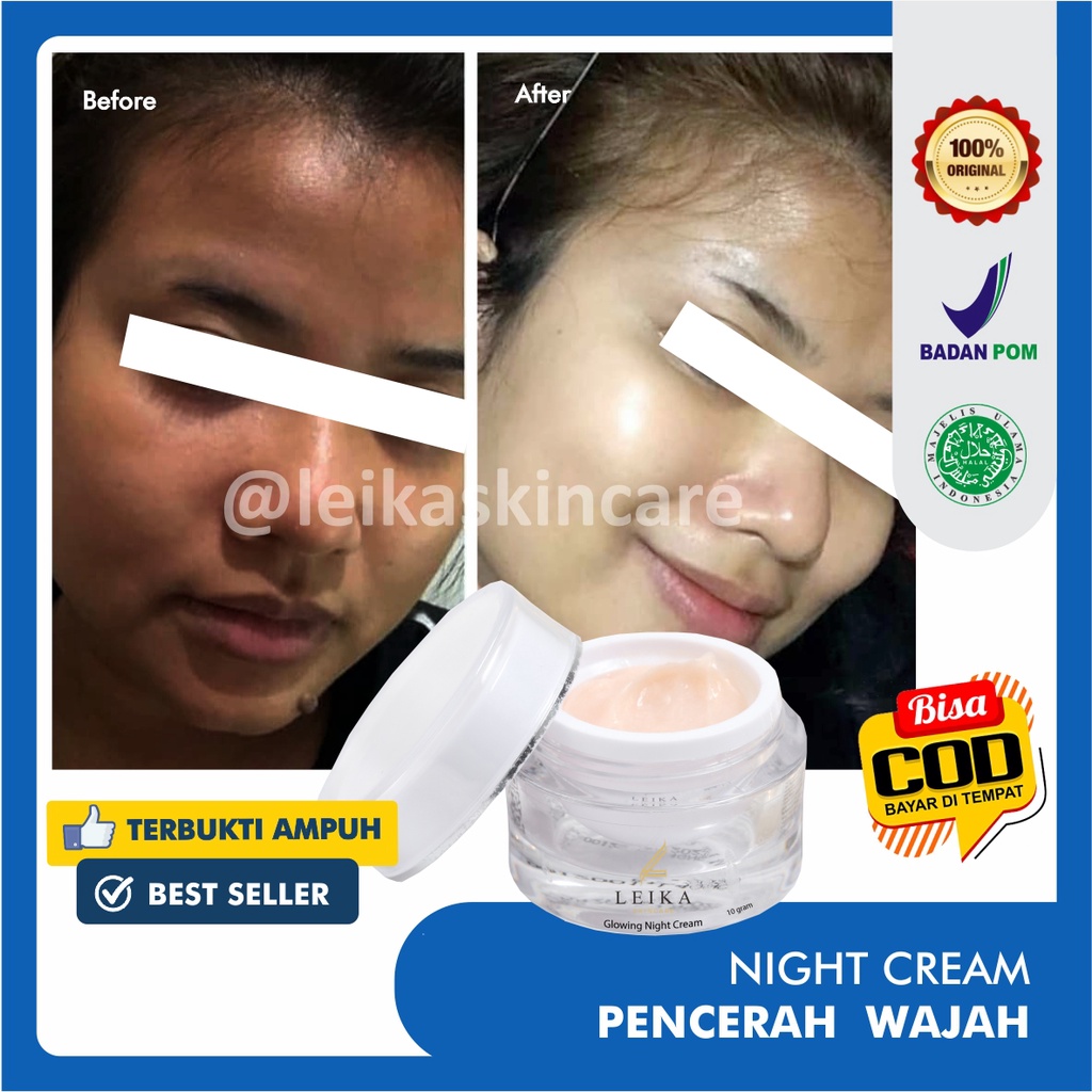 Menakjubkan! Cream Pencerah Wajah Kusam Glowing Cepat untuk Remaja BPOM Pria Wanita Asli Ampuh Krim Pemutih dan Pencerah / Perawatan wajah glowing HALAL MUI