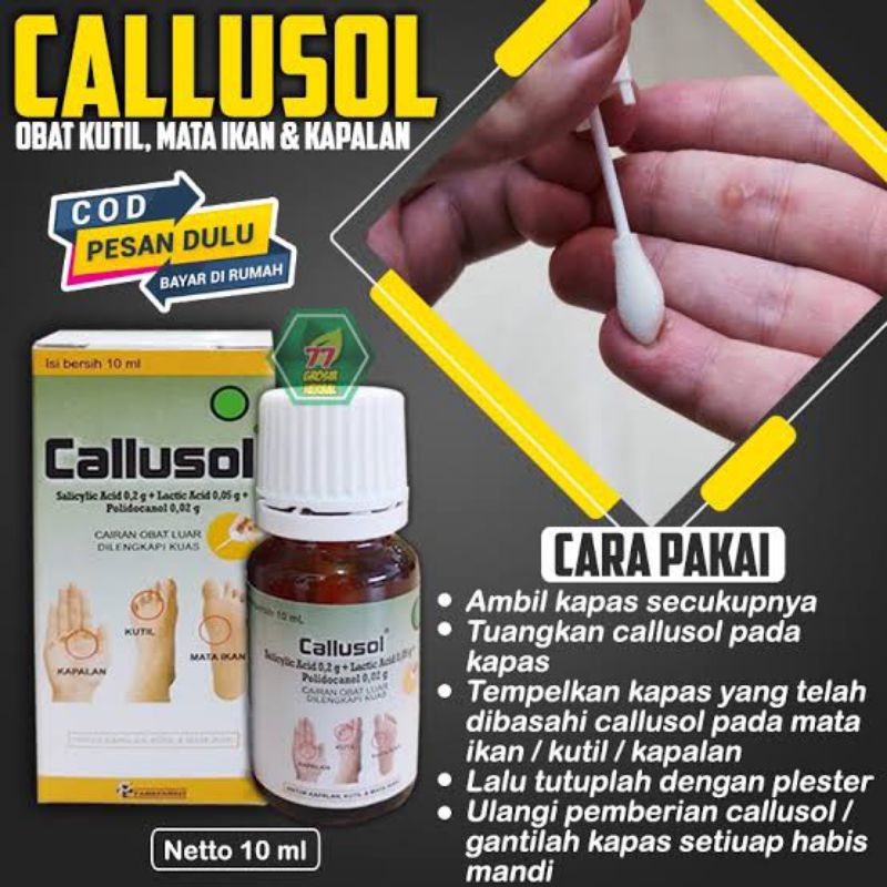 ORIGINAL CALLUSOL 10 ML / OBAT MATA IKAN &amp; KUTIL DAN KAPAL CALUSOL 10 ML