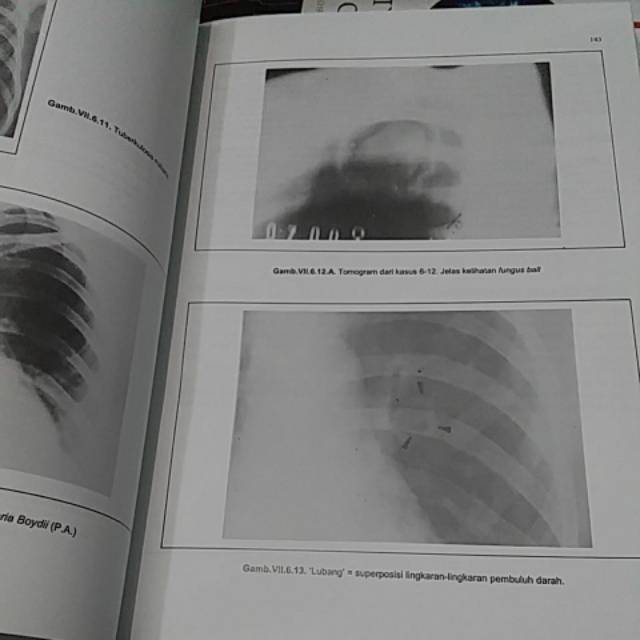 ( ORIGINAL ) BUKU RADIOLOGI DIAGNOSTIK FKUI EDISI 2 Th.2020 SJAHRIAR RASAD