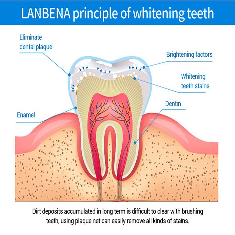 Esensi pemutih gigi Whitening teeth Cairan 10ml Menghapus Noda asap karang gigi kalkulus Kebersihan mulut Esensi pembersih Nada segar