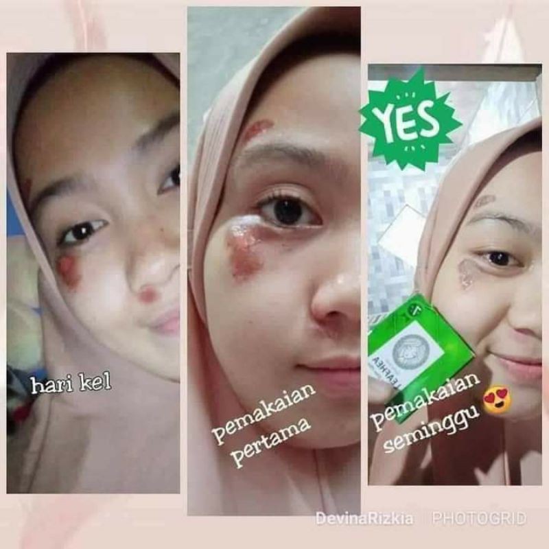 Leafhea Soap Original Box (Free Member)