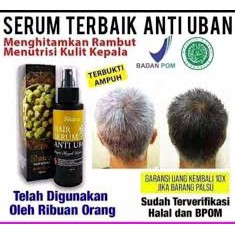 Anti uban nasa- Shanas- Hair Serum Anti Uban NASA Original - Serum Rambut Anti Uban hair