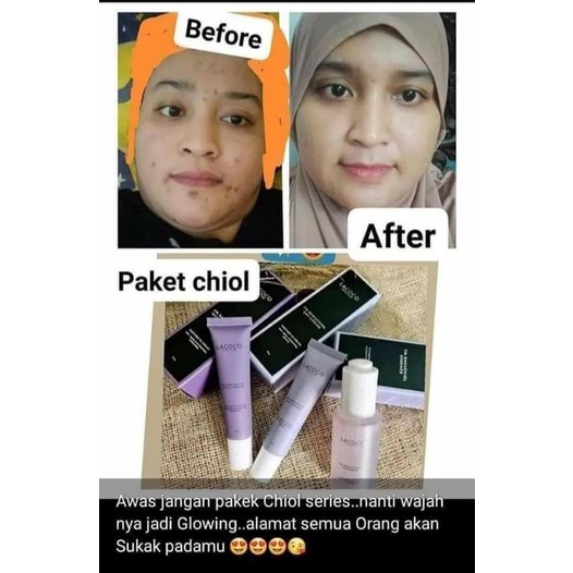 (BISA COD) Lacoco Bakuchiol 2% Original - SKINCARE VIRALL - PEMUTIH VIRAL - SKINCARE REMAJA - SKINCA